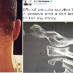 Natalya husband Tyson Kidd injury
