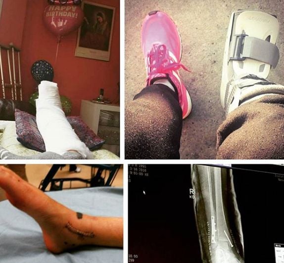 Dilraz Sidhu during her recovery period
